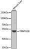 TRNA Methyltransferase 61B antibody, 23-378, ProSci, Western Blot image 