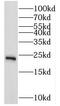RAB10, Member RAS Oncogene Family antibody, FNab06987, FineTest, Western Blot image 