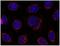 Stromal Interaction Molecule 1 antibody, M00312-1, Boster Biological Technology, Immunocytochemistry image 
