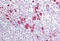 P21 (RAC1) Activated Kinase 1 antibody, MBS246894, MyBioSource, Immunohistochemistry frozen image 