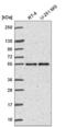 Fas Associated Factor Family Member 2 antibody, NBP2-57425, Novus Biologicals, Western Blot image 