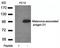 Melanoma-associated antigen D1 antibody, orb43376, Biorbyt, Western Blot image 