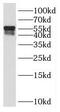 Paired box protein Pax-8 antibody, FNab06175, FineTest, Western Blot image 