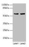 Cyp17 antibody, CSB-PA006392EA01HU, Cusabio, Western Blot image 