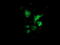 Stp antibody, M03500-1, Boster Biological Technology, Immunofluorescence image 