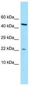 CGG Triplet Repeat Binding Protein 1 antibody, TA338345, Origene, Western Blot image 