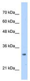 MRT4 Homolog, Ribosome Maturation Factor antibody, TA339334, Origene, Western Blot image 