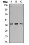 Reticulocalbin 1 antibody, orb411805, Biorbyt, Western Blot image 