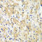 BCL2 antibody, LS-C330836, Lifespan Biosciences, Immunohistochemistry paraffin image 