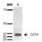 CD74 antibody, LS-C776017, Lifespan Biosciences, Western Blot image 