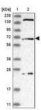 Ubiquitin carboxyl-terminal hydrolase 49 antibody, NBP1-81173, Novus Biologicals, Western Blot image 