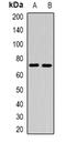 Carboxyl Ester Lipase antibody, abx225104, Abbexa, Western Blot image 