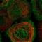 Metabolism Of Cobalamin Associated C antibody, NBP1-86597, Novus Biologicals, Immunocytochemistry image 