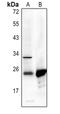 Cytochrome B-245 Alpha Chain antibody, MBS821526, MyBioSource, Western Blot image 