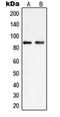 Phosphatidylinositol-4-phosphate 5-kinase type-1 gamma antibody, orb215079, Biorbyt, Western Blot image 