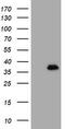 MAGE Family Member B18 antibody, M16185, Boster Biological Technology, Western Blot image 