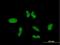Zinc Finger Protein 257 antibody, H00113835-B01P, Novus Biologicals, Immunofluorescence image 