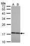 Crystallin Beta A4 antibody, LS-C186076, Lifespan Biosciences, Western Blot image 