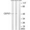 Centrosomal Protein 57 antibody, PA5-50005, Invitrogen Antibodies, Western Blot image 