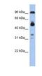 Coiled-coil domain-containing protein 144B antibody, NBP1-91467, Novus Biologicals, Western Blot image 