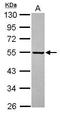Prolyl-TRNA Synthetase 2, Mitochondrial antibody, GTX120510, GeneTex, Western Blot image 