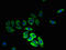 Major Facilitator Superfamily Domain Containing 14B antibody, A59370-100, Epigentek, Immunofluorescence image 