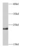HRas Proto-Oncogene, GTPase antibody, FNab04008, FineTest, Western Blot image 