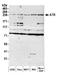 Serine/threonine-protein kinase ATR antibody, A300-137A, Bethyl Labs, Western Blot image 