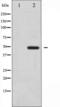Vitamin D3 receptor antibody, TA325969, Origene, Western Blot image 