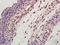Ta antibody, 251518, Abbiotec, Immunohistochemistry paraffin image 