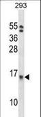 Eukaryotic Translation Initiation Factor 1B antibody, LS-C167674, Lifespan Biosciences, Western Blot image 