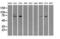 RalA Binding Protein 1 antibody, M01403-3, Boster Biological Technology, Western Blot image 