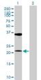 Ribosomal Protein L10a antibody, H00004736-D01P, Novus Biologicals, Western Blot image 