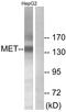 c-met antibody, LS-C118181, Lifespan Biosciences, Western Blot image 