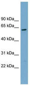 Carnosine Dipeptidase 2 antibody, TA344899, Origene, Western Blot image 