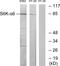 Ribosomal protein S6 kinase alpha-6 antibody, PA5-38824, Invitrogen Antibodies, Western Blot image 