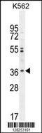 Olfactory Receptor Family 2 Subfamily M Member 3 antibody, 55-475, ProSci, Western Blot image 