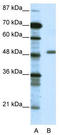 Transcriptional Adaptor 3 antibody, TA329304, Origene, Western Blot image 