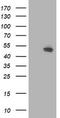 CCM2 Scaffold Protein antibody, LS-C173232, Lifespan Biosciences, Western Blot image 