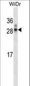 Homeobox A7 antibody, LS-B9160, Lifespan Biosciences, Western Blot image 
