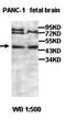 Isobutyryl-CoA dehydrogenase, mitochondrial antibody, orb77646, Biorbyt, Western Blot image 