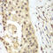 Fibroblast Growth Factor Receptor 1 antibody, 15-021, ProSci, Immunohistochemistry paraffin image 