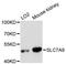 Solute Carrier Family 7 Member 9 antibody, LS-C747919, Lifespan Biosciences, Western Blot image 