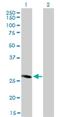 Four and a half LIM domains protein 5 antibody, H00009457-M01, Novus Biologicals, Western Blot image 