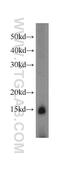 CXXC Repeat Containing Interactor Of PDZ3 Domain antibody, 11211-1-AP, Proteintech Group, Western Blot image 