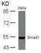 SMAD Family Member 1 antibody, GTX50625, GeneTex, Western Blot image 