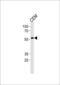 RUNX Family Transcription Factor 2 antibody, GTX81326, GeneTex, Western Blot image 
