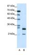 Heme Oxygenase 2 antibody, orb331581, Biorbyt, Western Blot image 