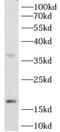 Interleukin 1 Beta antibody, FNab04209, FineTest, Western Blot image 