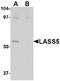 Ceramide Synthase 5 antibody, AP22658PU-N, Origene, Western Blot image 